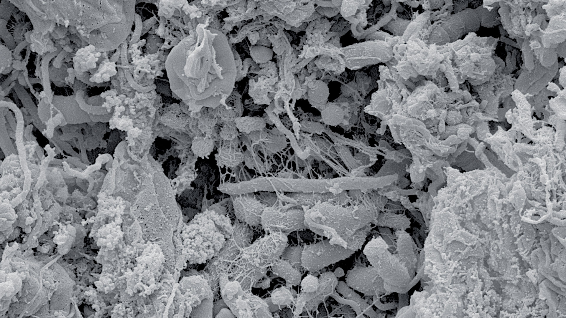 Microscopic image of oral biofilm