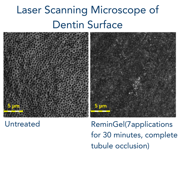 Remingel Banner (800 x 800 px) (600 x 600 px) (3)